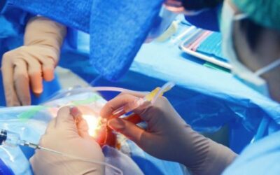 Operare la cataratta con il laser è sicuro?